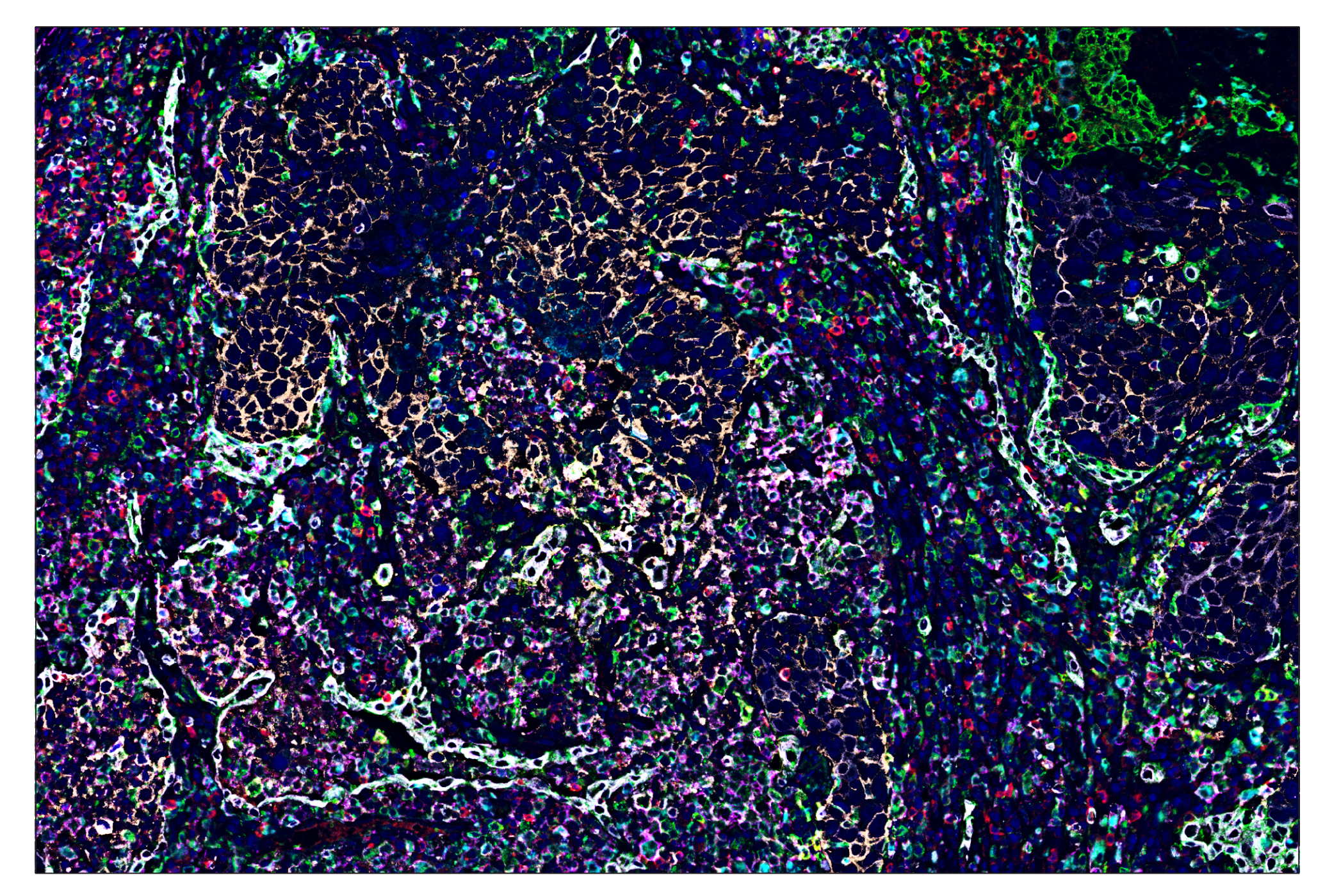 Immunohistochemistry Image 6: XCR1 (D2F8T) & CO-0015-488 SignalStar™ Oligo-Antibody Pair