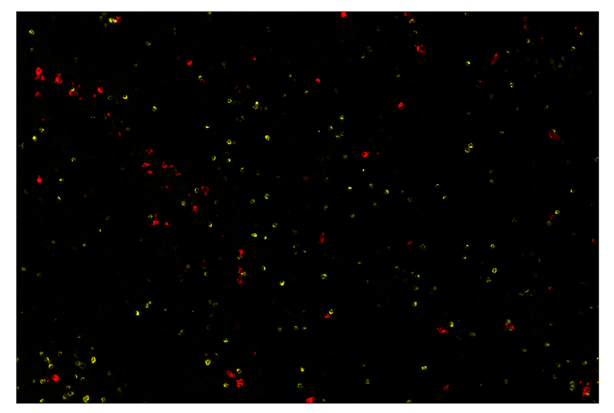 Immunohistochemistry Image 7: XCR1 (D2F8T) & CO-0015-488 SignalStar™ Oligo-Antibody Pair