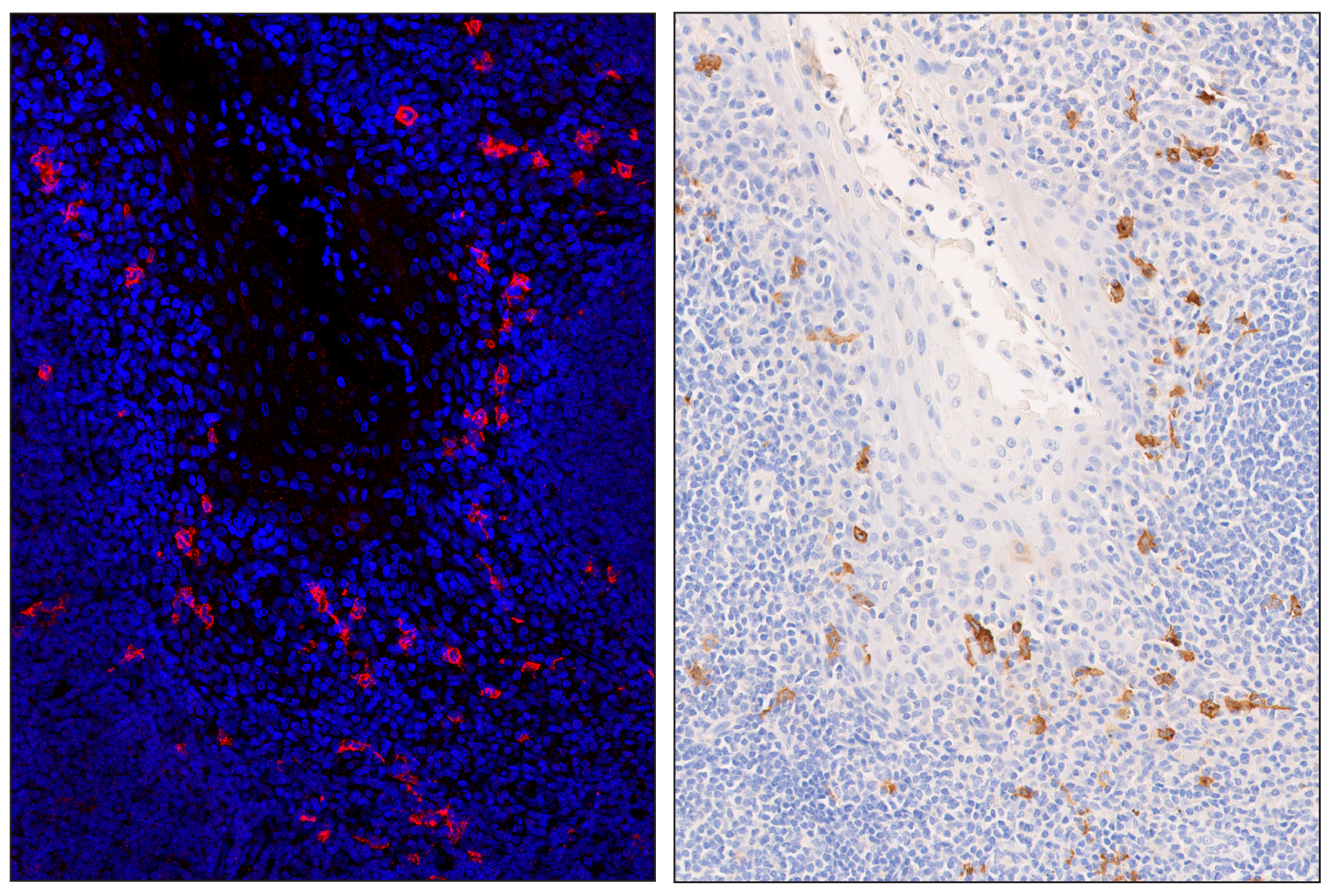 Immunohistochemistry Image 5: XCR1 (D2F8T) & CO-0015-488 SignalStar™ Oligo-Antibody Pair
