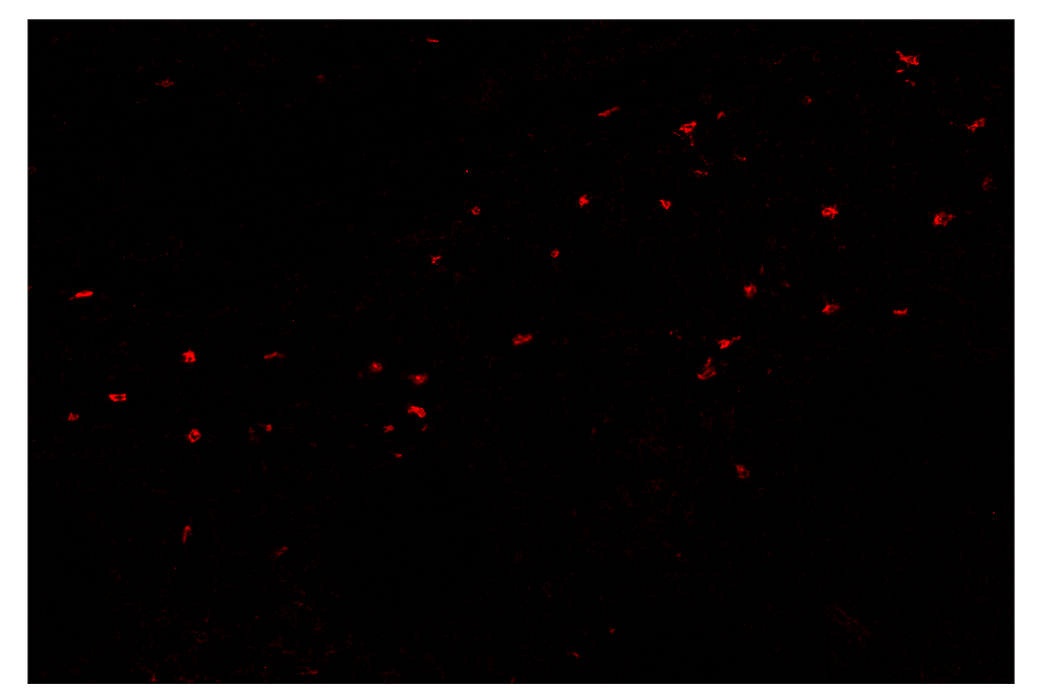 Immunohistochemistry Image 4: XCR1 (D2F8T) & CO-0015-488 SignalStar™ Oligo-Antibody Pair