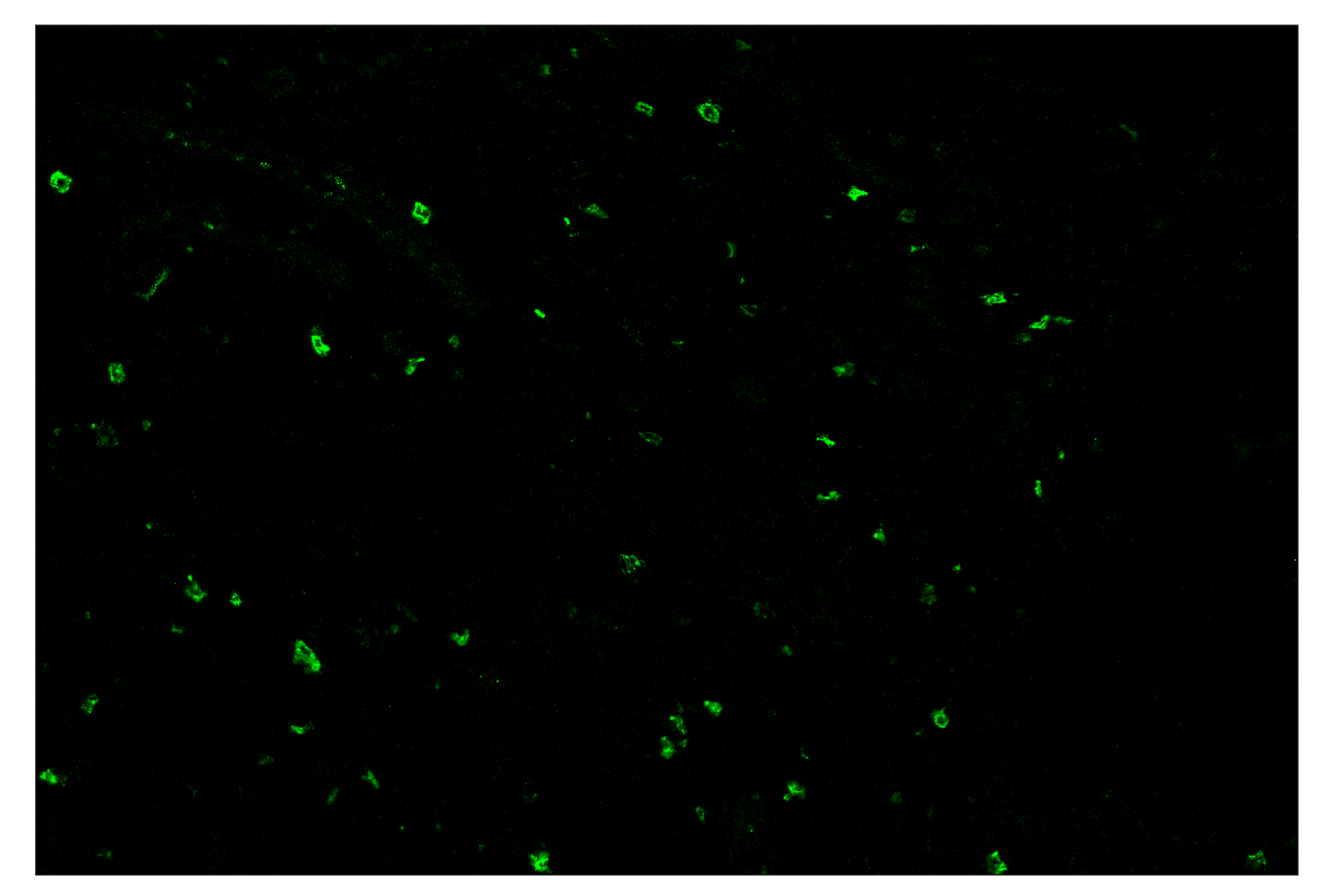 Immunohistochemistry Image 2: XCR1 (D2F8T) & CO-0015-488 SignalStar™ Oligo-Antibody Pair