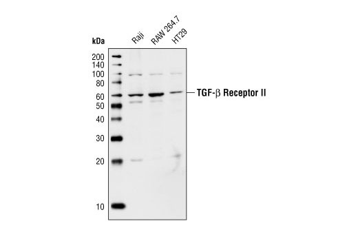 Western Blotting Image 1: TGF-beta Receptor II Antibody