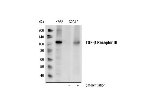 Western Blotting Image 1: TGF-β Receptor III Antibody