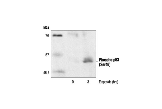 Image 11: p53 Antibody Sampler Kit