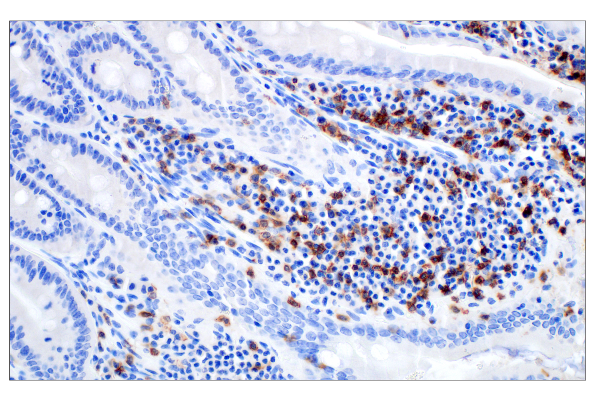 Immunohistochemistry Image 6: CD4 (D7D2Z) Rabbit mAb