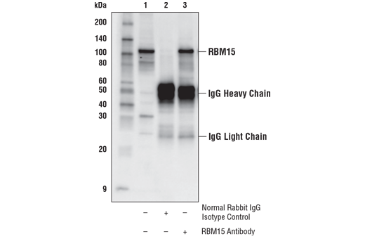 Immunoprecipitation Image 1: RBM15 Antibody