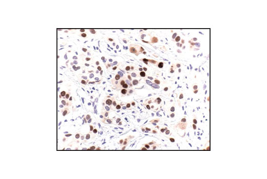 Immunohistochemistry Image 1: p53 (7F5) Rabbit mAb