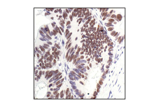 Immunohistochemistry Image 2: p53 (7F5) Rabbit mAb