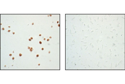 Immunohistochemistry Image 3: p53 (7F5) Rabbit mAb