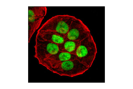 Immunofluorescence Image 1: p53 (7F5) Rabbit mAb
