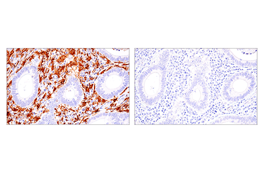 Immunohistochemistry Image 6: LAIR-1 (E7X6I) XP® Rabbit mAb (BSA and Azide Free)