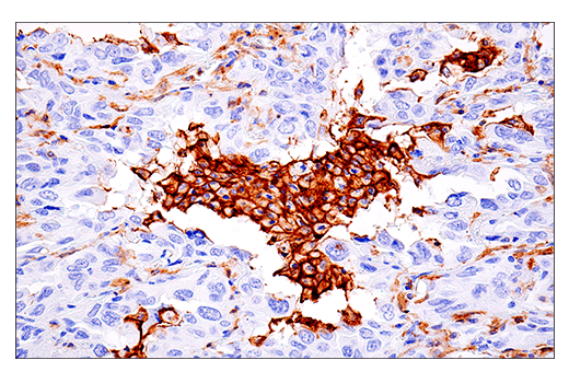 Immunohistochemistry Image 7: LAIR-1 (E7X6I) XP® Rabbit mAb (BSA and Azide Free)