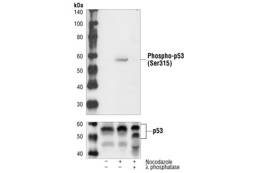 Western Blotting Image 1: Phospho-p53 (Ser315) Antibody