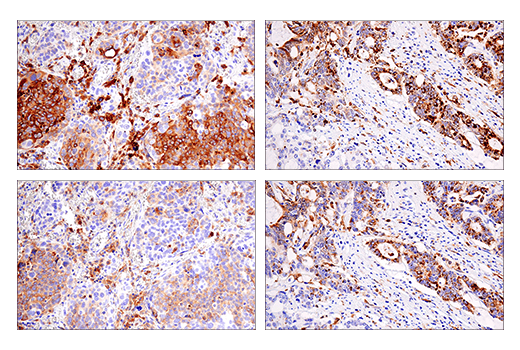 Immunohistochemistry Image 9: HLA-DRA (E9R2Q) XP® Rabbit mAb (BSA and Azide Free)