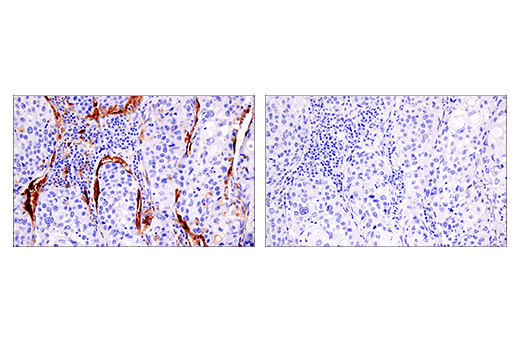 Immunohistochemistry Image 6: HLA-DRA (E9R2Q) XP® Rabbit mAb (BSA and Azide Free)