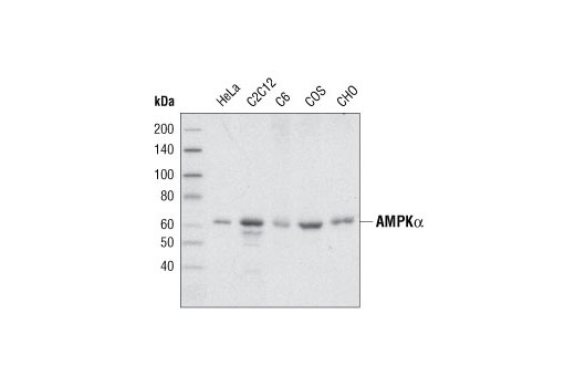 Western Blotting Image 1: AMPKα Antibody