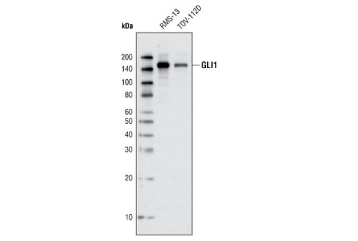 Western Blotting Image 1: GLI1 (V812) Antibody