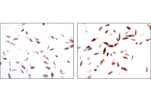  Image 13: PPARγ Regulated Fatty Acid Metabolism Antibody Sampler Kit
