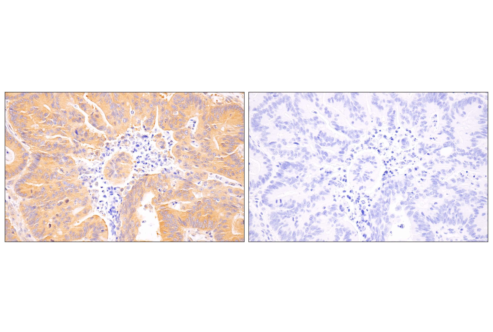 undefined Image 26: AMPK and ACC Antibody Sampler Kit