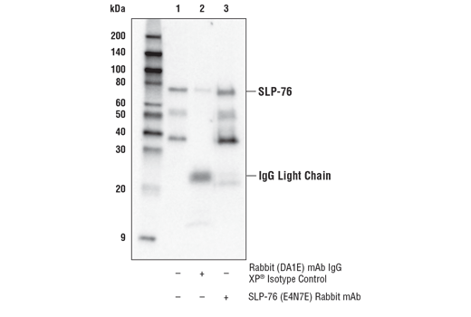 Immunoprecipitation Image 1: SLP-76 (E4N7E) Rabbit mAb