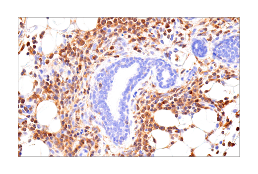 Immunohistochemistry Image 1: SLP-76 (E4N7E) Rabbit mAb