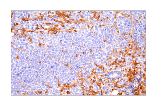 Immunohistochemistry Image 2: SLP-76 (E4N7E) Rabbit mAb