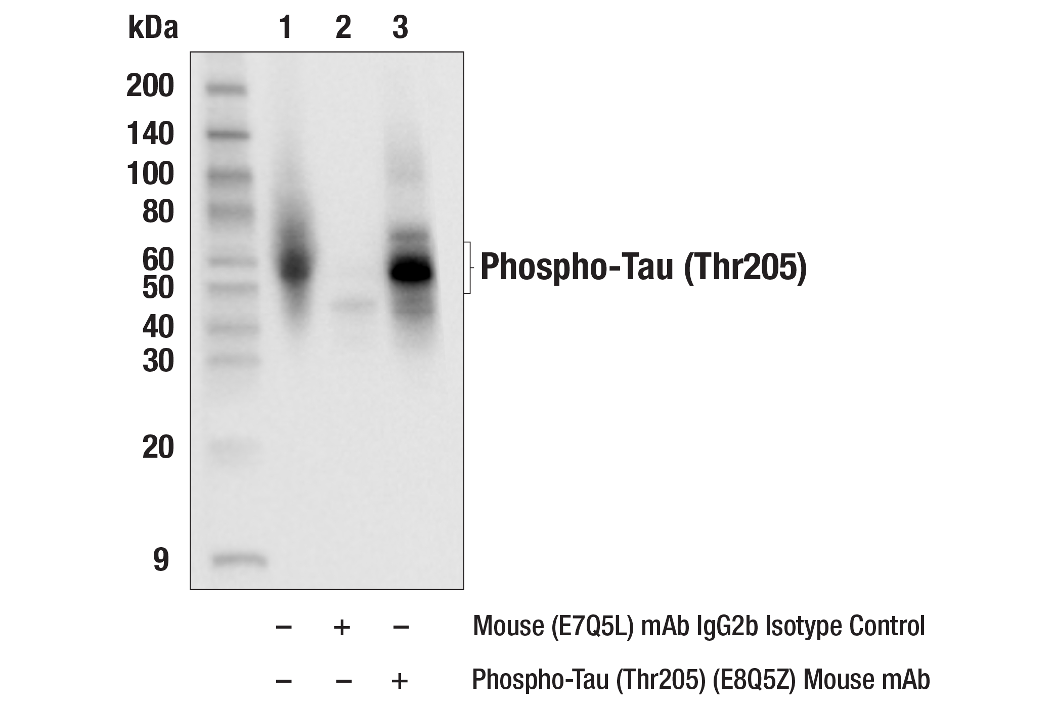 Immunoprecipitation Image 1: Phospho-Tau (Thr205) (E8Q5Z) Mouse mAb