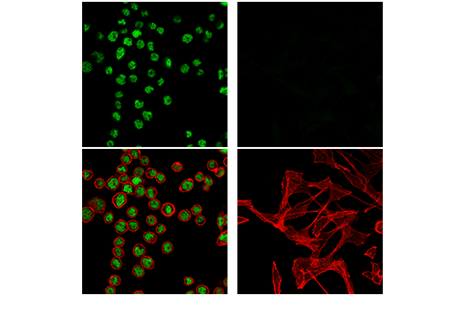 Immunofluorescence Image 1: HNF1α (E3H9V) Rabbit mAb (IF Specific)