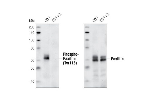 Western Blotting Image 1: Phospho-Paxillin (Tyr118) Antibody