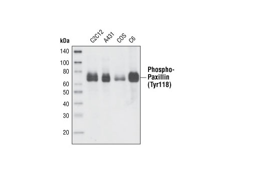 Western Blotting Image 2: Phospho-Paxillin (Tyr118) Antibody