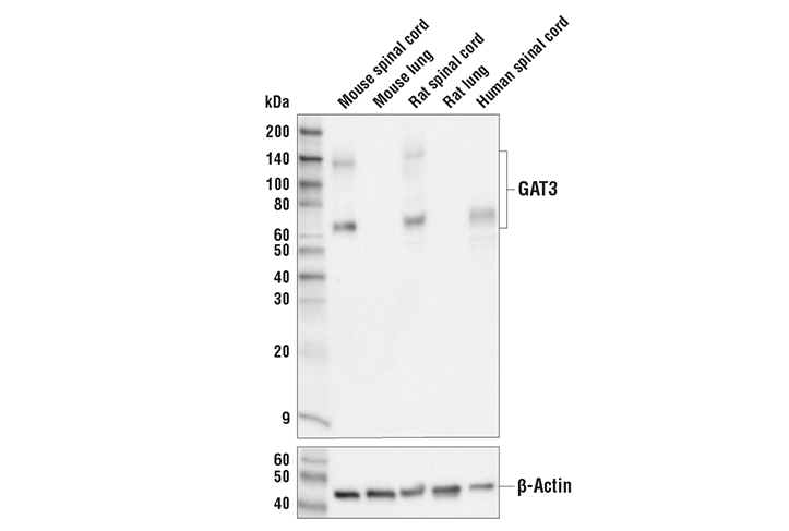 Western Blotting Image 1: GAT3 Antibody