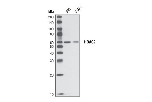 Western Blotting Image 1: HDAC2 Antibody