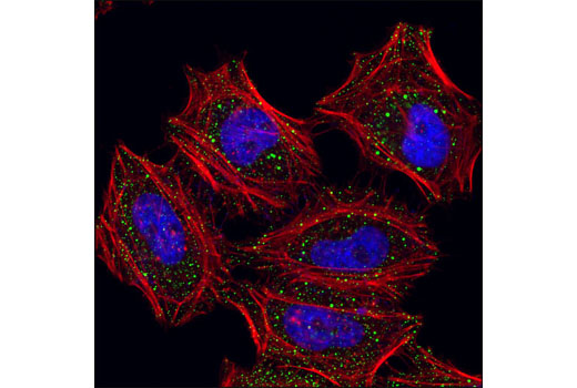 Immunofluorescence Image 1: EDC4/Ge-1 Antibody