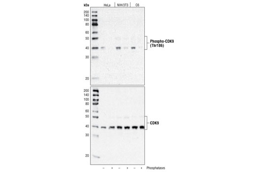 Western Blotting Image 1: Phospho-CDK9 (Thr186) Antibody