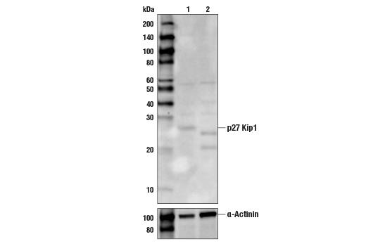 Western Blotting Image 1: p27 Kip1 Antibody