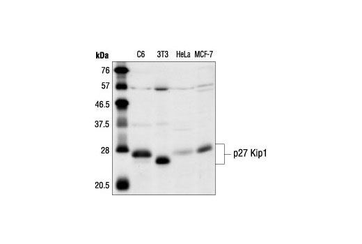 Western Blotting Image 2: p27 Kip1 Antibody