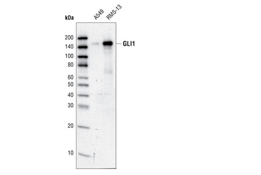 Western Blotting Image 1: GLI1 Antibody