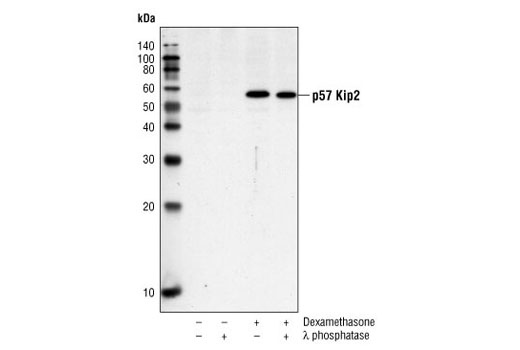  Image 3: Cyclin Dependent Kinase Inhibitor Antibody Sampler Kit