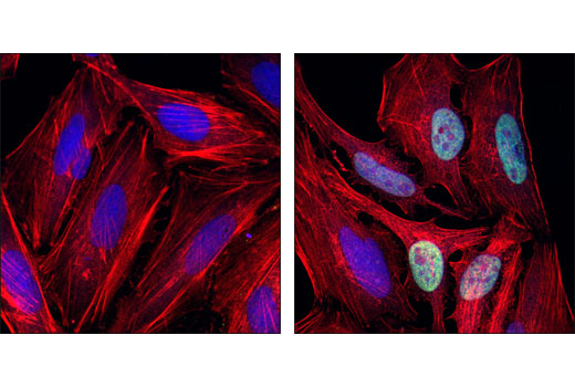 Immunofluorescence Image 1: p57 Kip2 Antibody