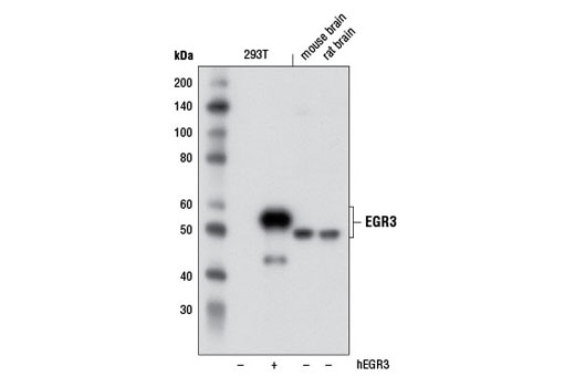 Western Blotting Image 1: EGR3 Antibody
