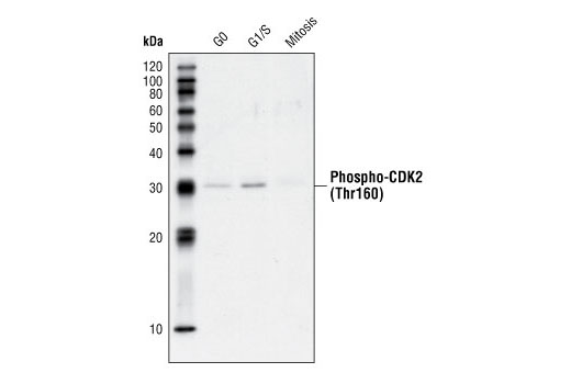 Western Blotting Image 1: Phospho-CDK2 (Thr160) Antibody