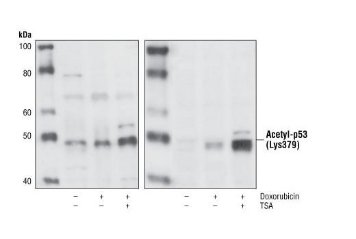  Image 5: p53 Antibody Sampler Kit