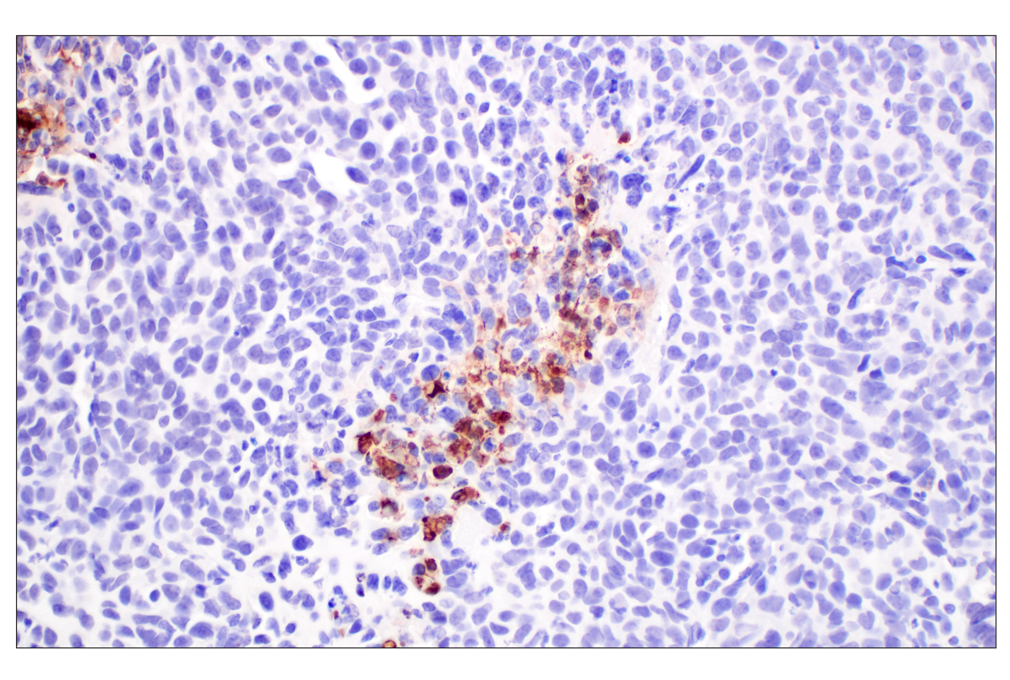 Immunohistochemistry Image 7: Citrullinated Histone H3 (Arg2) (F3C9B) Rabbit mAb (BSA and Azide Free)