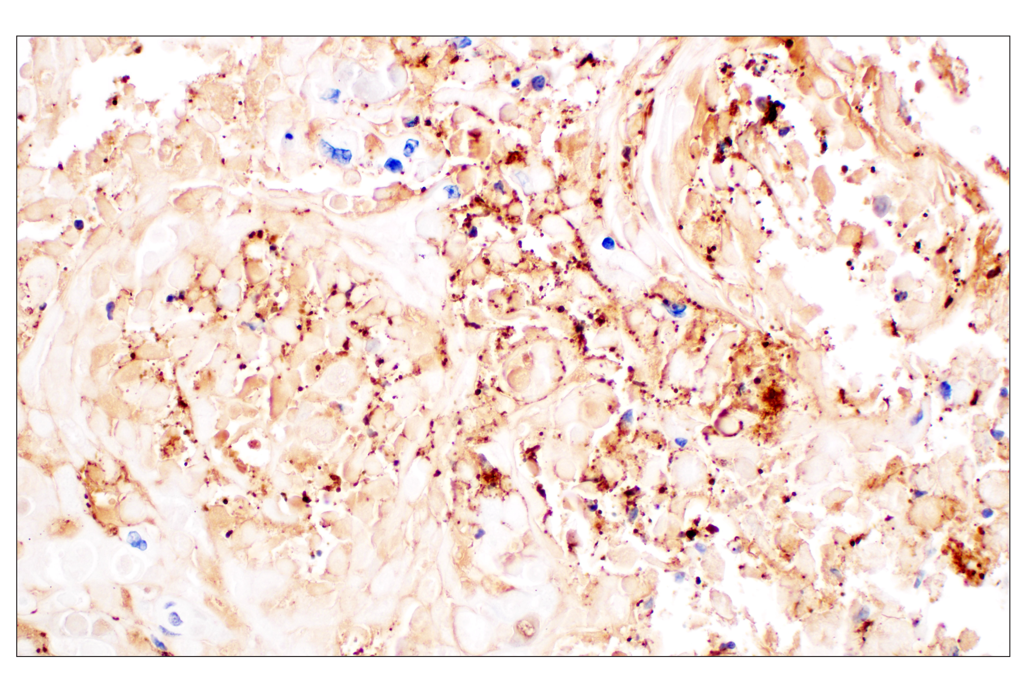 Immunohistochemistry Image 5: Citrullinated Histone H3 (Arg2) (F3C9B) Rabbit mAb (BSA and Azide Free)