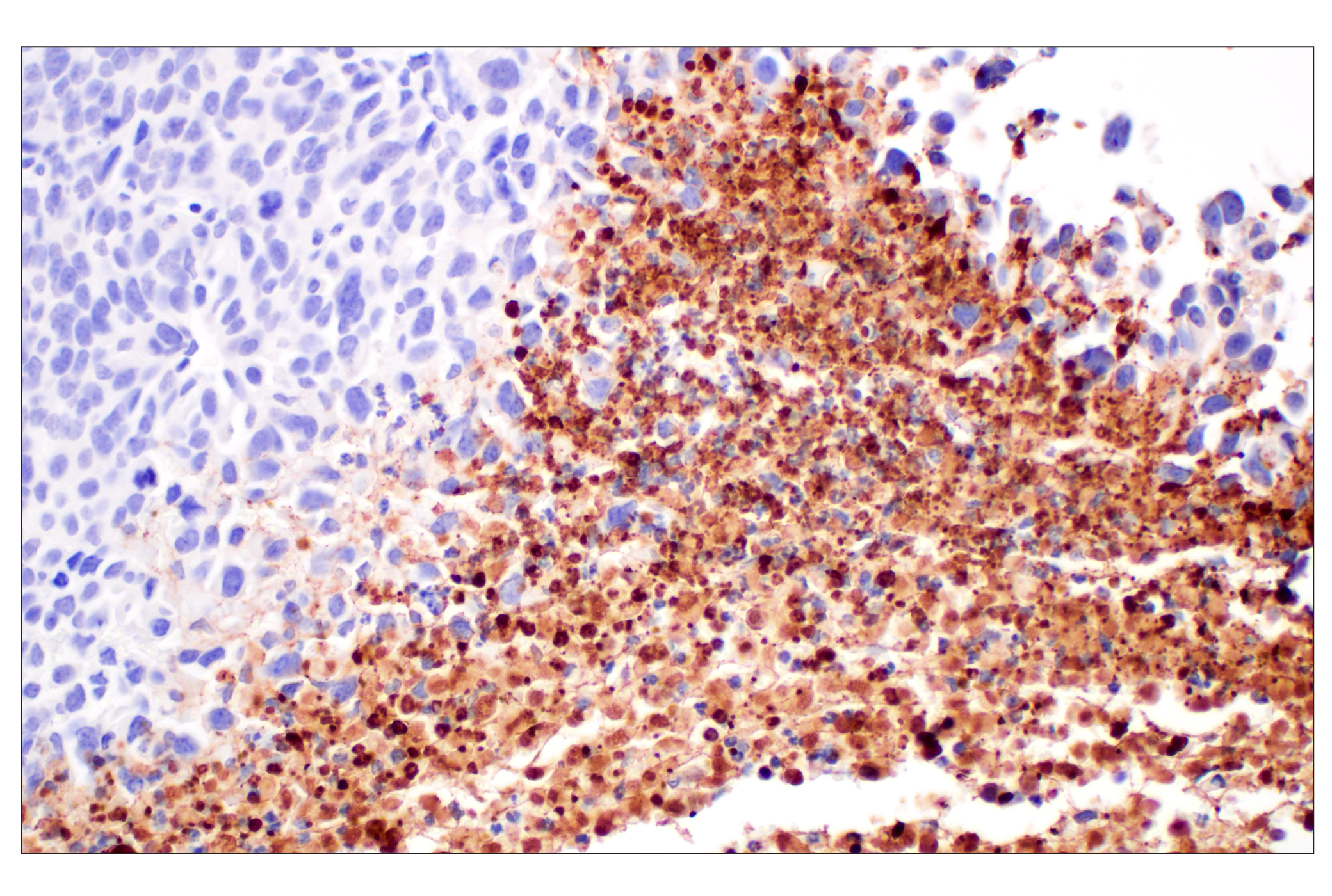 Immunohistochemistry Image 6: Citrullinated Histone H3 (Arg2) (F3C9B) Rabbit mAb (BSA and Azide Free)