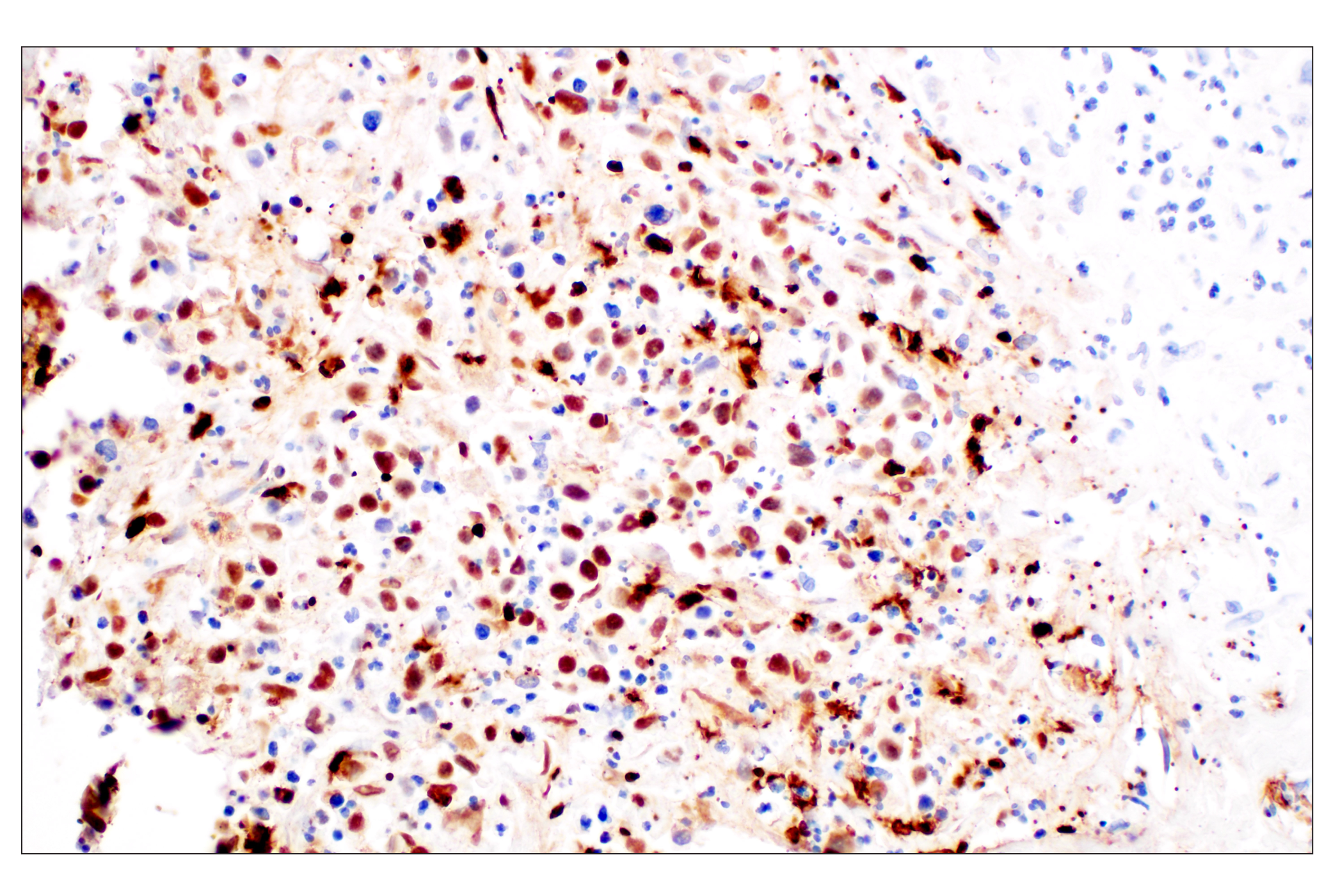 Immunohistochemistry Image 1: Citrullinated Histone H3 (Arg2) (F3C9B) Rabbit mAb (BSA and Azide Free)