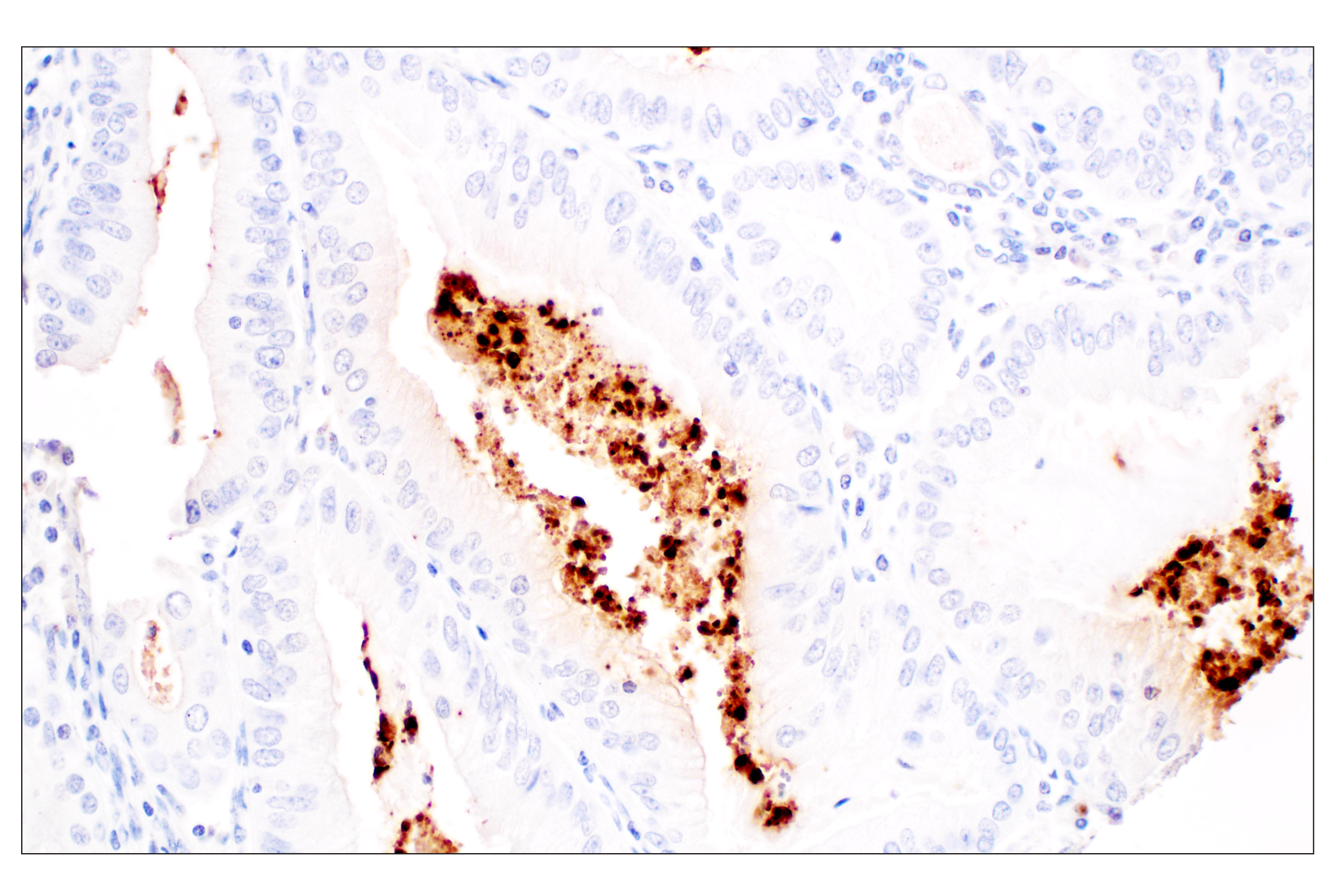 Immunohistochemistry Image 2: Citrullinated Histone H3 (Arg2) (F3C9B) Rabbit mAb (BSA and Azide Free)