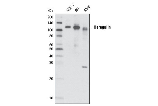 Western Blotting Image 1: Heregulin Antibody