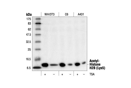 Western Blotting Image 1: Acetyl-Histone H2B (Lys5) Antibody