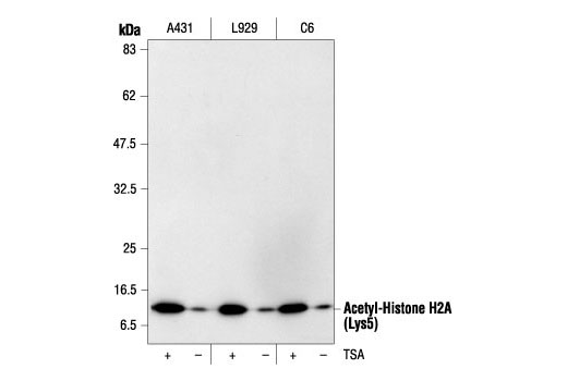 Western Blotting Image 1: Acetyl-Histone H2A (Lys5) Antibody